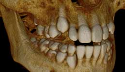 Tooth's Three Dimensional Anatomy